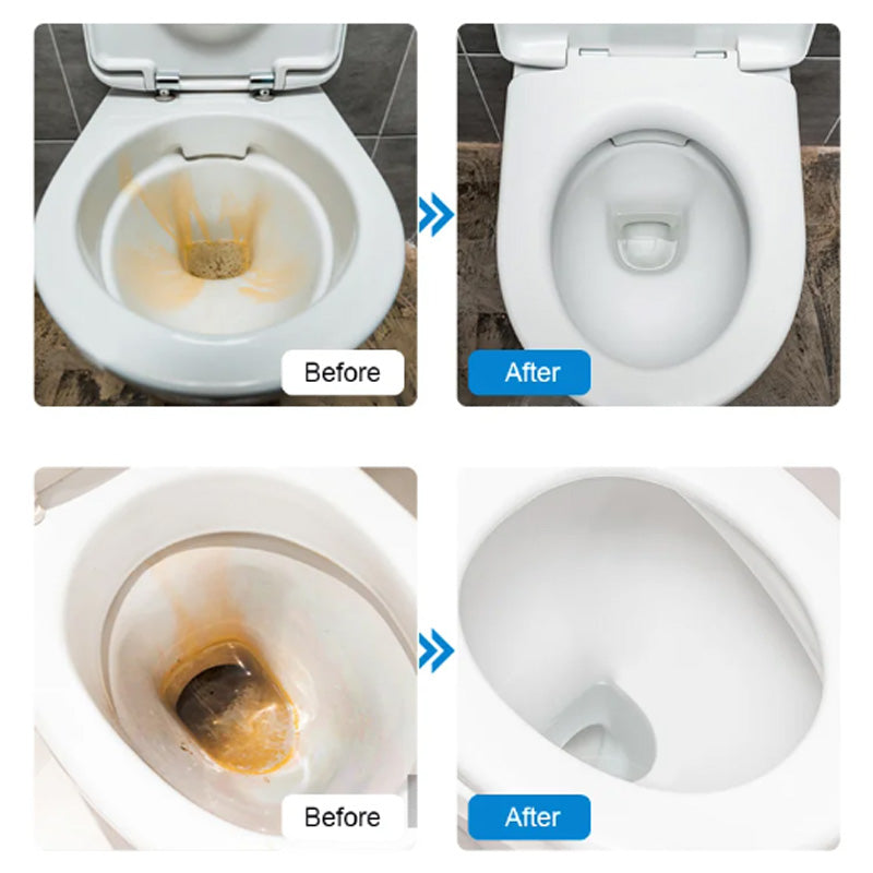🔥New Japanese cleaning technology👉Powerful Toilet Bowl Cleaner Tablets💥Get 50% off for a limited time!