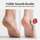 Double-Sided Foot Scraper for Callus Removal