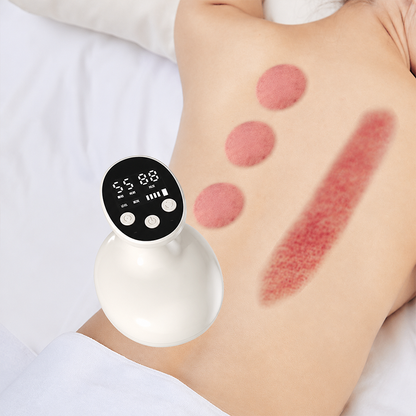 Heated Vacuum Cupping Massager